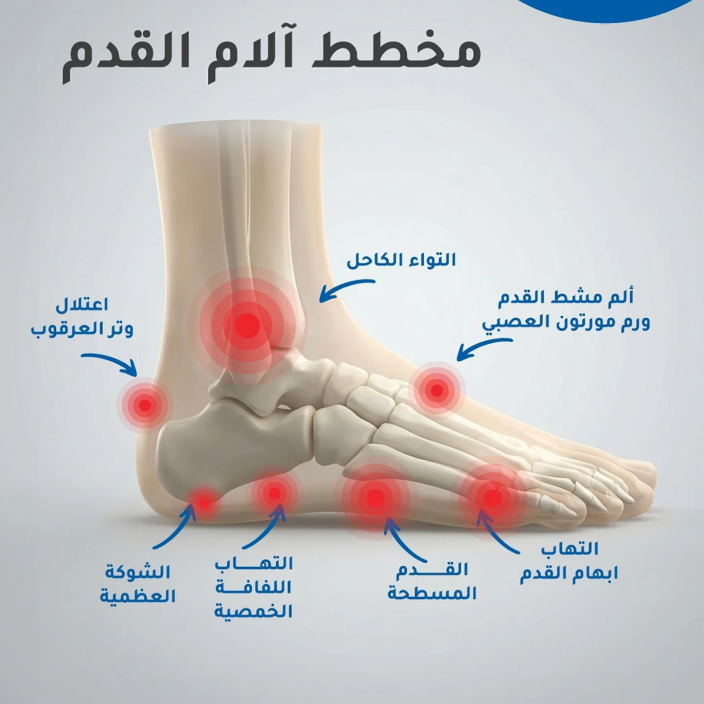 الوكعات وانحراف إصبع القدم